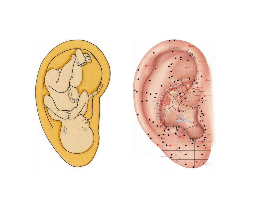 Jezien-Erkelens-ooracupunctuur-Emmen