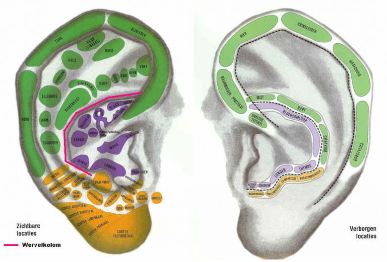 Ooracupunctuur Emmen, Drenthe